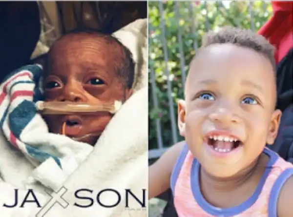 Checkout This Amazing Transformation Of This Little Baby (Photo)